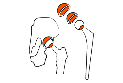 5 axis cnc machines are perfect for machining organic shapes within the medical industry